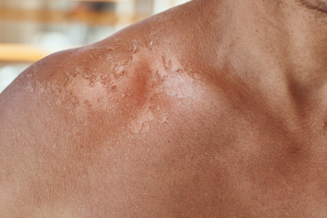 Understanding Your Skin's Resilience